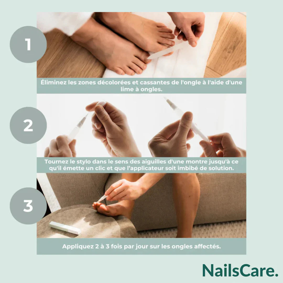 NailsCare pen- Fini mycoses des ongles