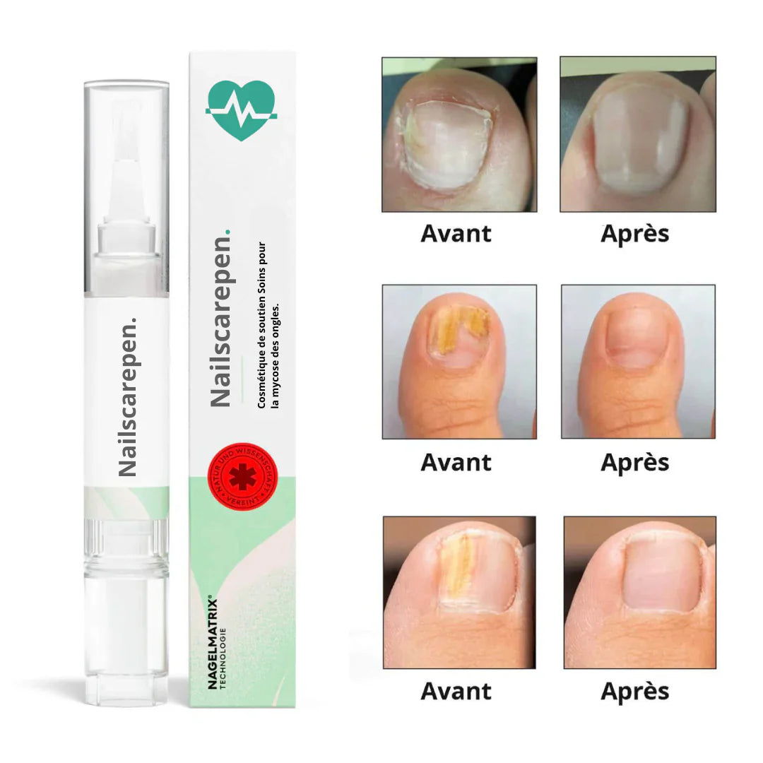 NailsCare pen- Fini mycoses des ongles